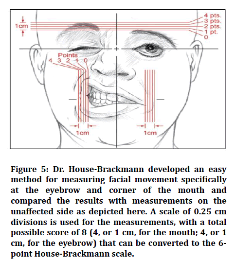 medical-dental-science-facial-movement