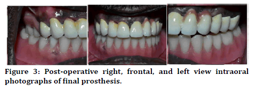 medical-dental-science-final-prosthesis