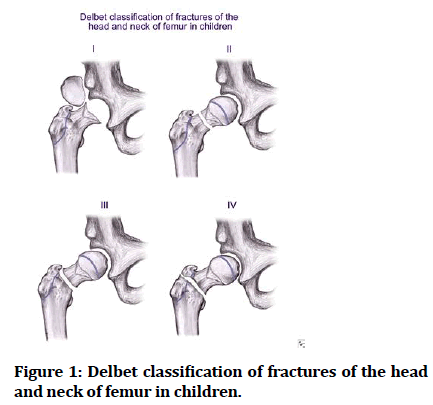 medical-dental-science-fractures-head