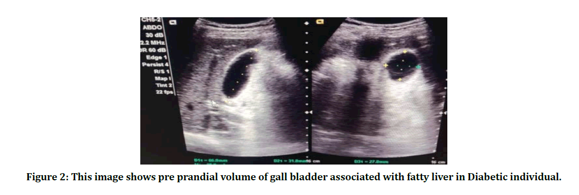 medical-dental-science-gall-bladder