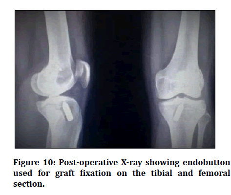 medical-dental-science-graft-fixation