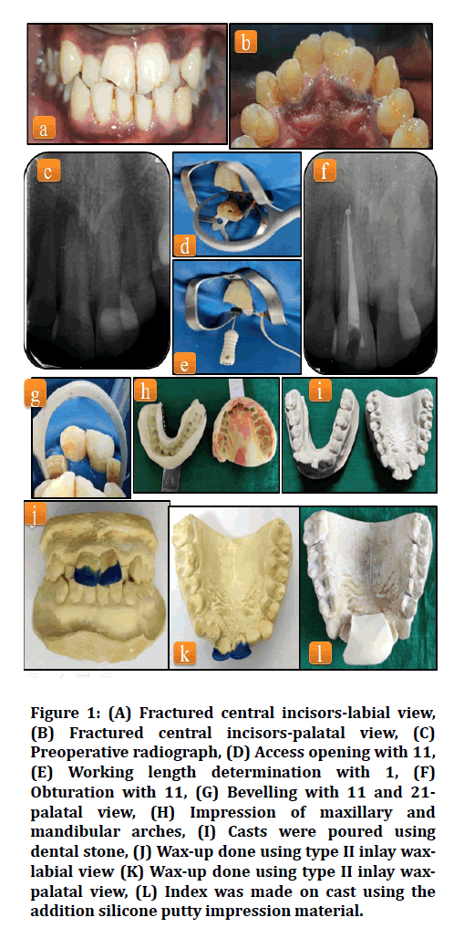 medical-dental-science-incisors-labial