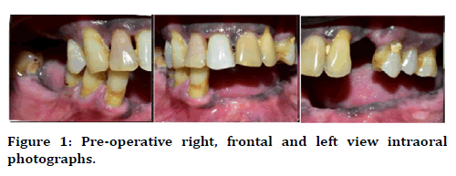 medical-dental-science-intraoral-photographs