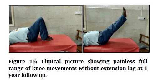 medical-dental-science-knee-movements