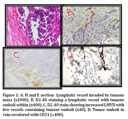 medical-dental-science-lymphatic-vessel