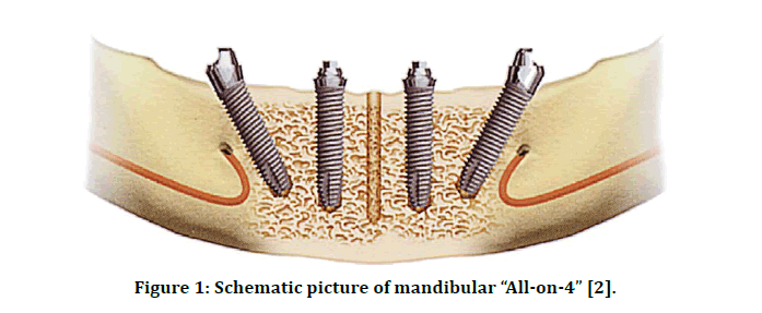 medical-dental-science-mandibular