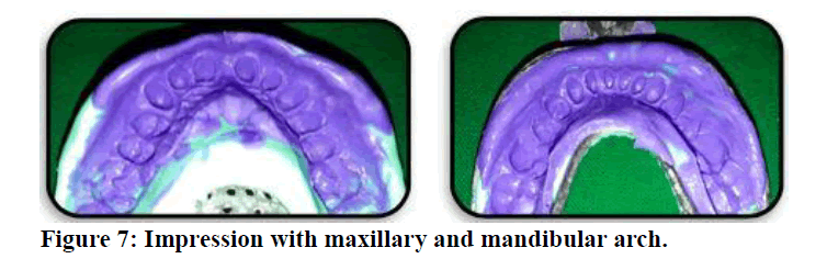 medical-dental-science-mandibular-arch