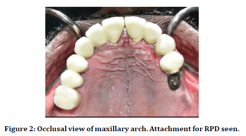 medical-dental-science-maxillary-arch