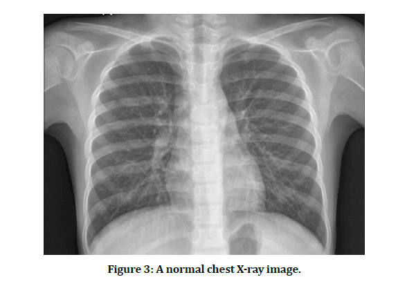 medical-dental-science-normal-chest