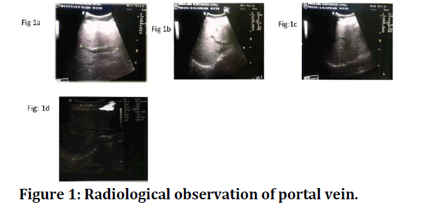 medical-dental-science-portal-vein