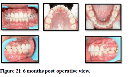 medical-dental-science-post-operative