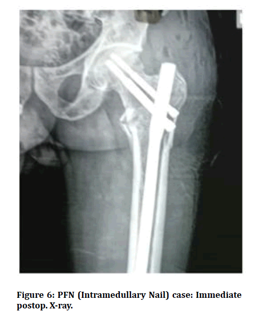 medical-dental-science-postop-X-ray