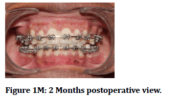 medical-dental-science-postoperative-Months
