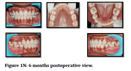 medical-dental-science-postoperative-Months