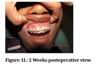 medical-dental-science-postoperative-Weeks