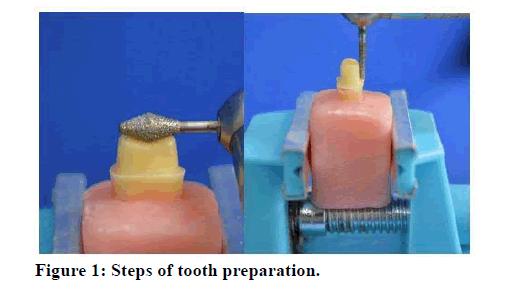 medical-dental-science-tooth-preparation