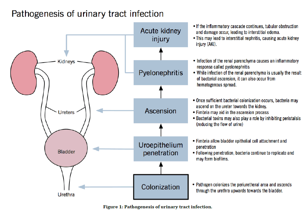medical-dental-science-urinary-tract-infection