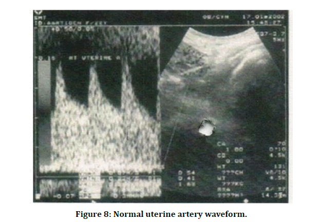 medical-dental-science-uterine-artery