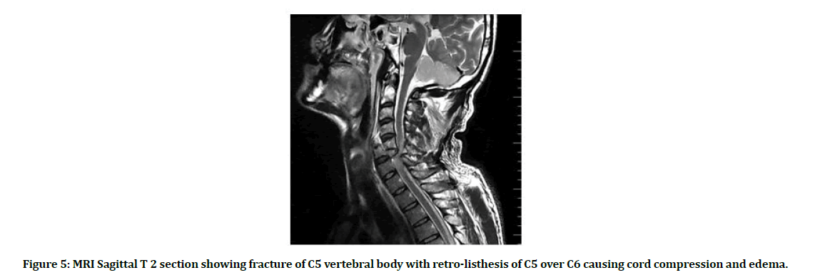 medical-dental-science-vertebral-body