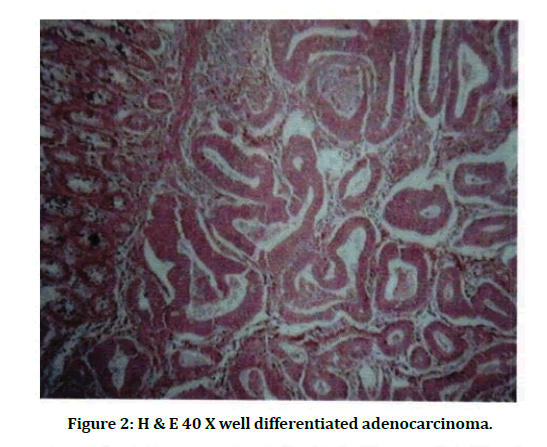 medical-dental-science-well-differentiated