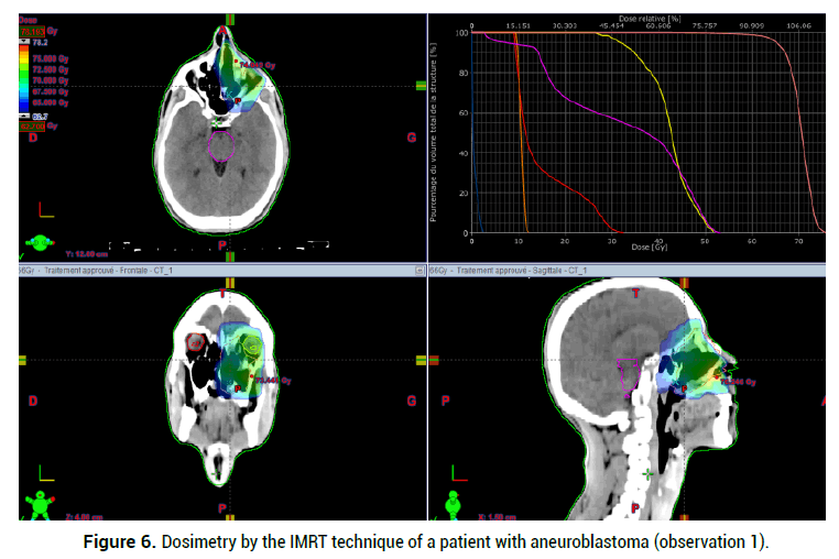 medical-reports-Dosimetry