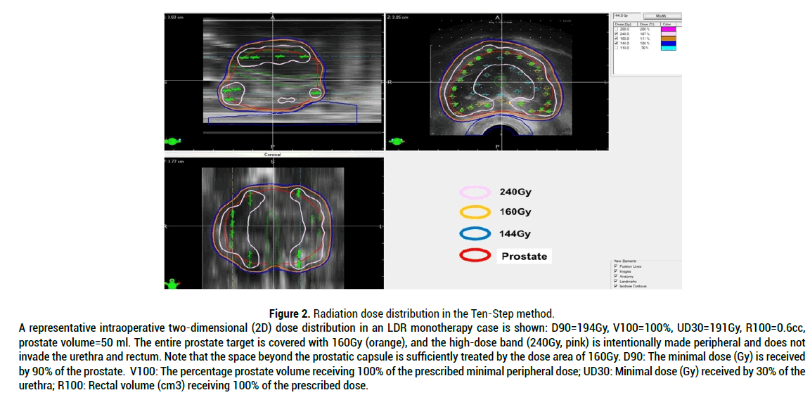 medical-reports-Radiation