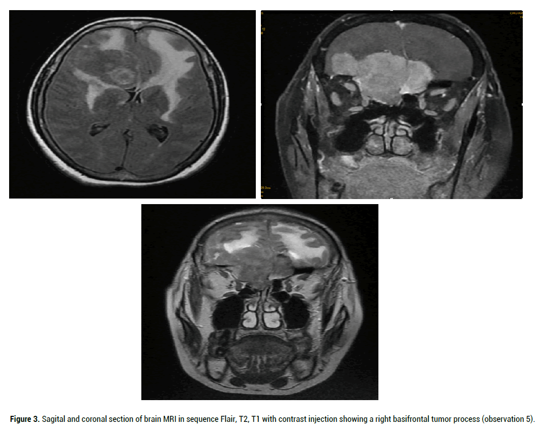 medical-reports-Sagital