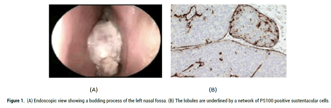 medical-reports-endoscopic