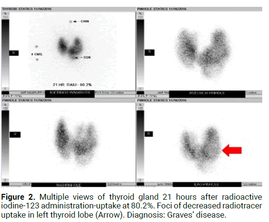 medical-reports-thyroid