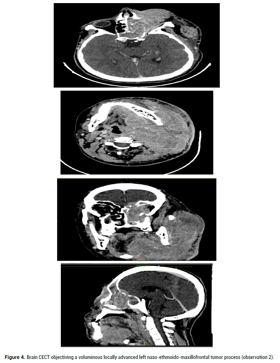 medical-reports-voluminous