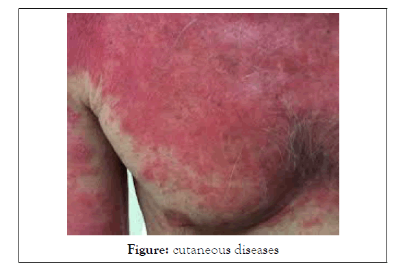 medical-surgical-cutaneous