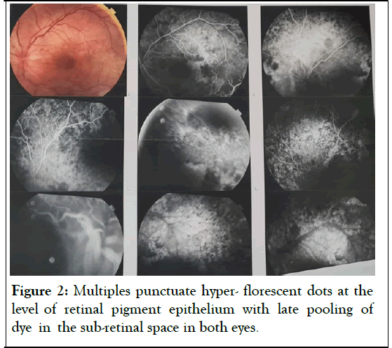 epithelium