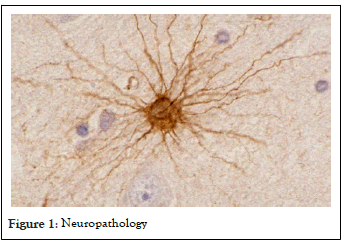 medical-surgical-neuropathology