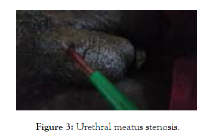 medical-surgical-urology-meatus