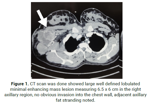 oncology-cancer-case-reports-ct-scan