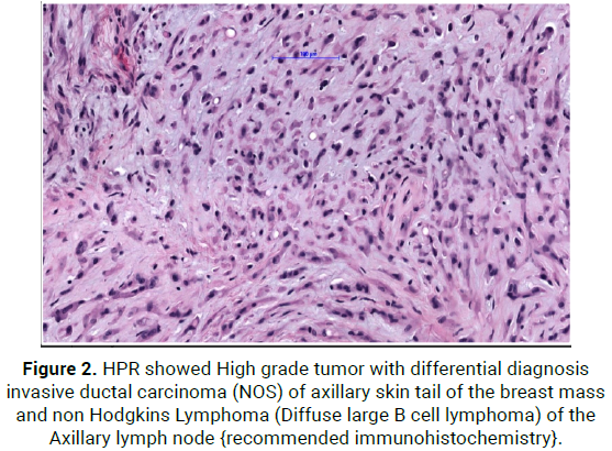 oncology-cancer-case-reports-diagnosis