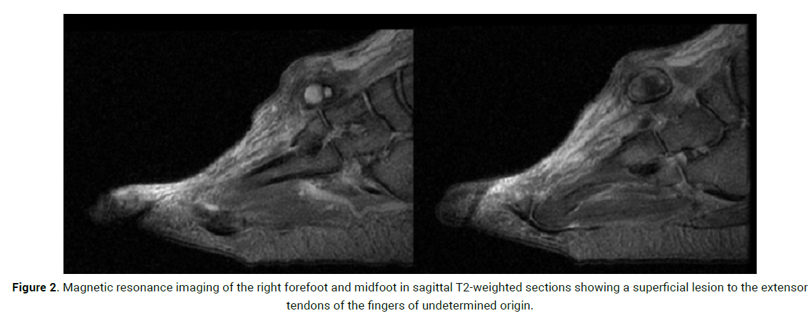 oncology-cancer-case-reports-magnetic-resonance