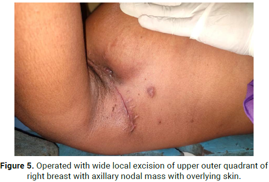 oncology-cancer-case-reports-overlying-skin
