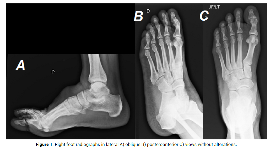 oncology-cancer-case-reports-posteroanterior