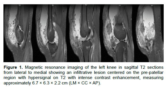 oncology-cancer-magnetic-resonance