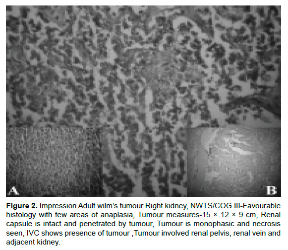 oncology-cancer-tumour-monophasic