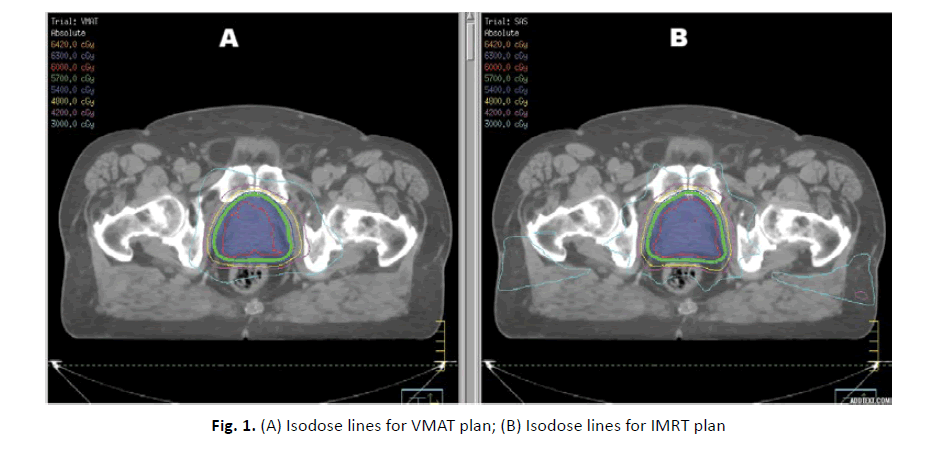 oncology-radiotherapy-Isodose-lines