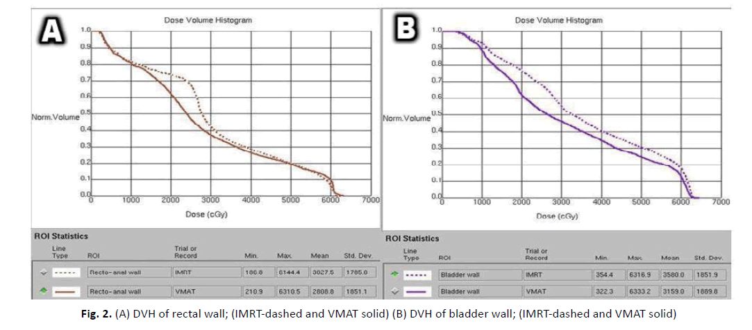 oncology-radiotherapy-bladder-wall