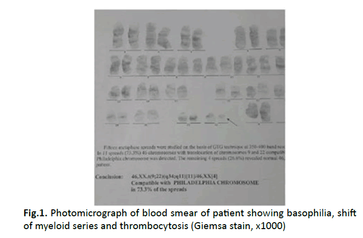 oncology-radiotherapy-blood-smear
