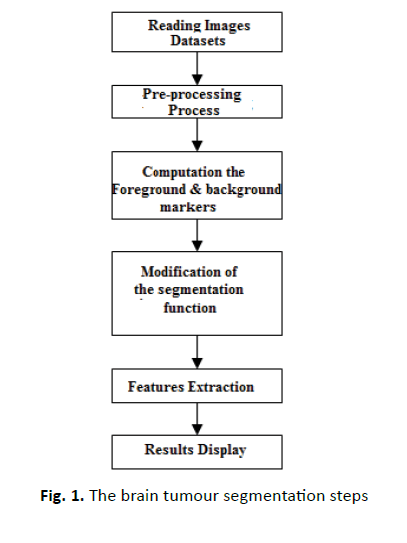 oncology-radiotherapy-brain-tumour