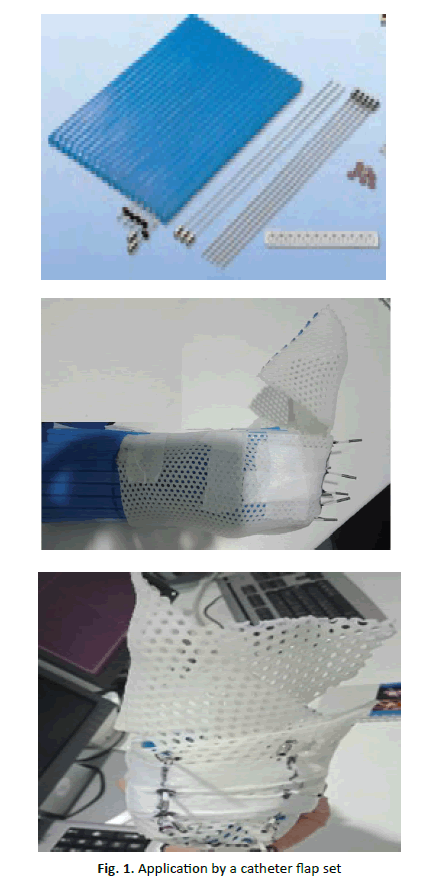 oncology-radiotherapy-catheter-flap