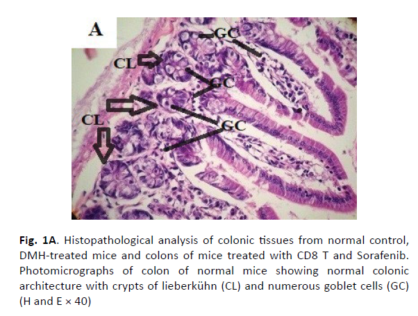 oncology-radiotherapy-colonic-tissues