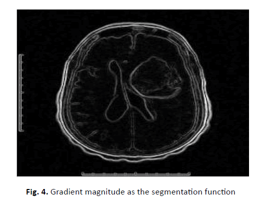 oncology-radiotherapy-gradient-magnitude