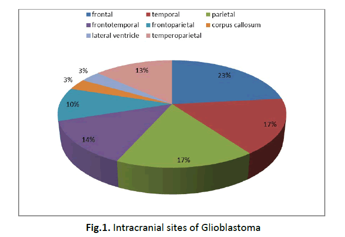 oncology-radiotherapy-intracranial-sites