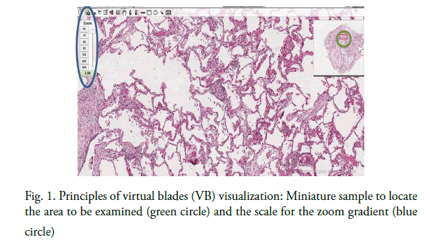 oncology-radiotherapy-miniature-sample